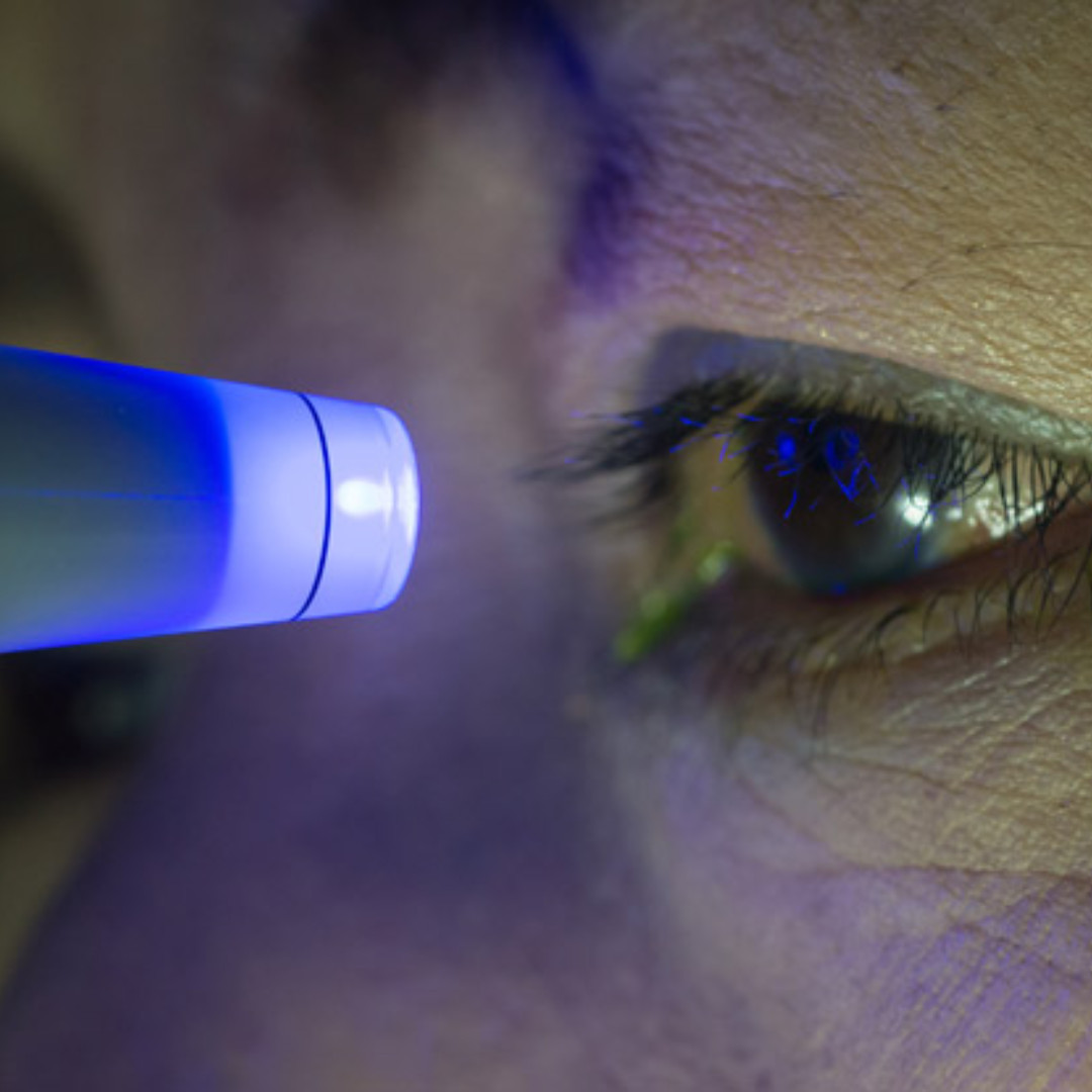 Glaucoma often has no early symptoms—but it can lead to permanent vision loss if left untreated.  That’s why regular eye pressure testing is so important. It’s quick, painless, and can help detect signs of glaucoma before you even notice changes in your vision.  Routine eye exams save sight. Don’t skip them.  At Mississippi Retina Associates, we’re here to help you protect your vision for the long term.  #GlaucomaAwareness #EyeHealth