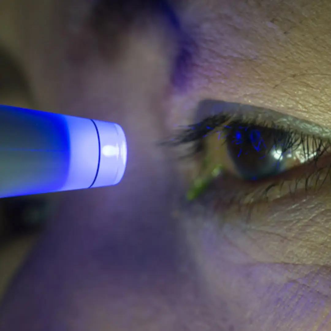 Glaucoma often has no early symptoms—but it can lead to permanent vision loss if left untreated.  That’s why regular eye pressure testing is so important. It’s quick, painless, and can help detect signs of glaucoma before you even notice changes in your vision.  Routine eye exams save sight. Don’t skip them.  At Mississippi Retina Associates, we’re here to help you protect your vision for the long term.  #GlaucomaAwareness #EyeHealth